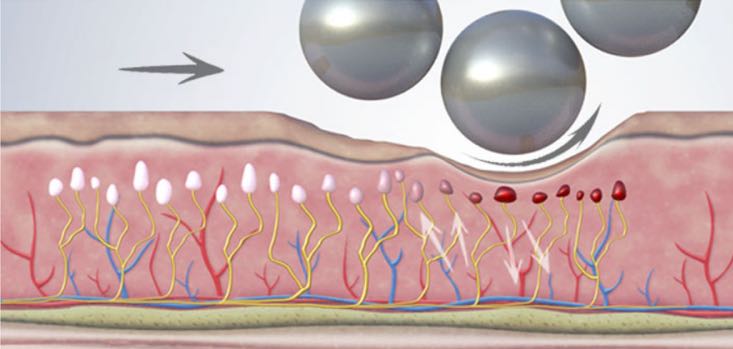 1. Schmerzlinderung – Endospheres