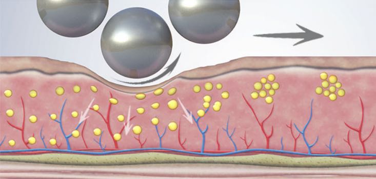 4. Körperformung – Endospheres