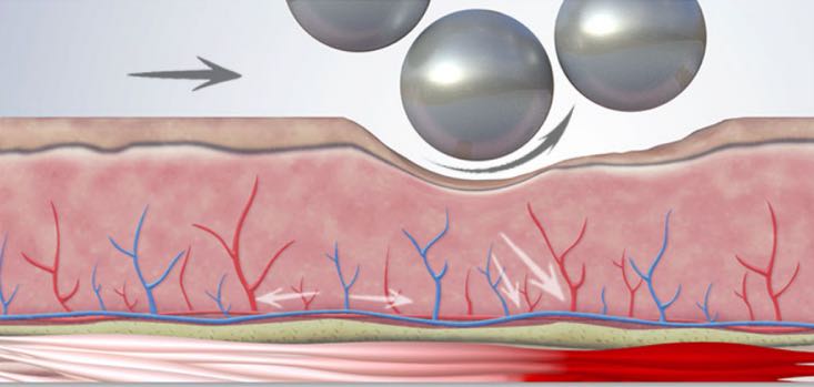 5. Muskelaufbau – Endospheres